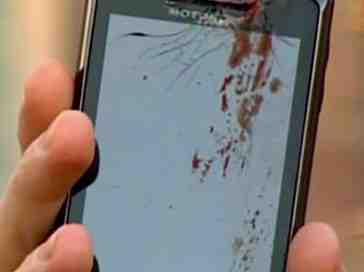 DROID 2 lashes out, allegedly explodes in a man's ear