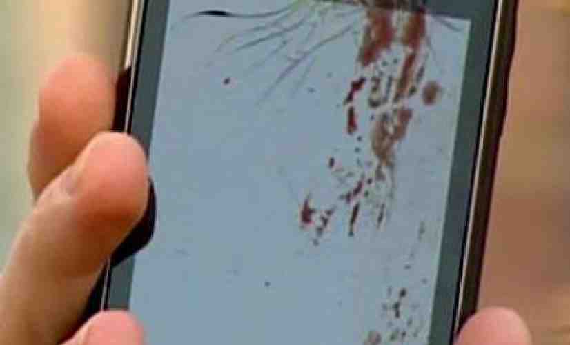 DROID 2 lashes out, allegedly explodes in a man's ear